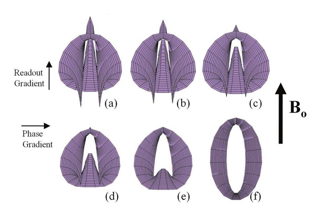 Determining the Location of Metallic Needle from MR Images Distorted by Susceptibility Difference length and diameter of the cylindrical rod were 20 cm and 1 mm, respectively.