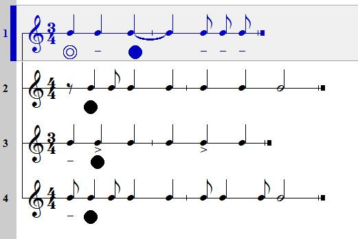 당김음 (syncopation) 눈솔 67 쪽 일정셈. 여림의리듬이어떤경우에여린박위치로센박이당겨지는것 1. 붙임줄에의한당김음 2.