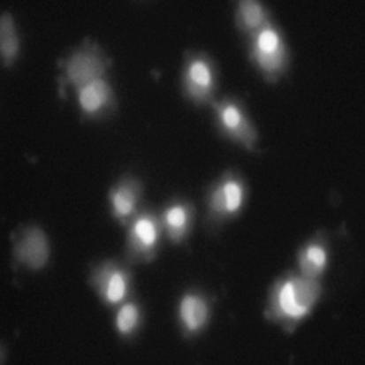 (C) Apoptotic body formation was observed under a fluorescence microscope after Hoechst 33342 staining and arrows indicate apoptotic bodies.