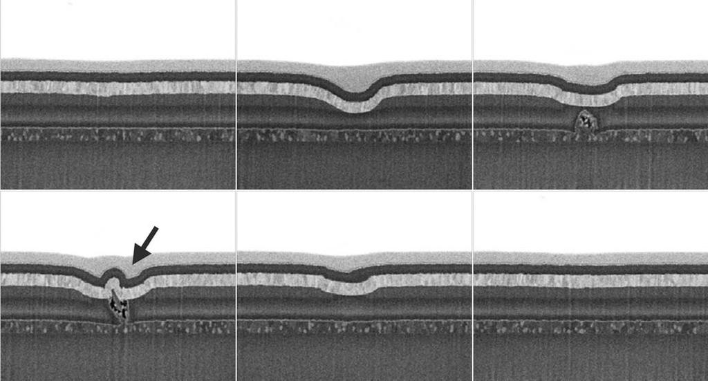 Kim JS et al. : 351 (a) (b) (c) 400 nm 400 nm 400 nm (d) (e) (f) 400 nm 400 nm 400 nm Fig. 1.