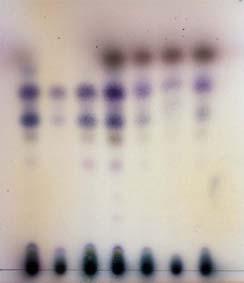 난다. 4) 바닐린황산에탄올시액으로발색한것 (A) 에서는검체 2 번과 3 번에서 Rf 0.8 의반점이나타나지않는다. 5) 바닐린황산에탄올시액으로발색한것 (B) 에서는검체 2 번에서 R f 0.7 의황록색반점이나타나지않고, 검체 2, 3 번에서 R f 0.45 의자홍색반점이나타나지않는다.