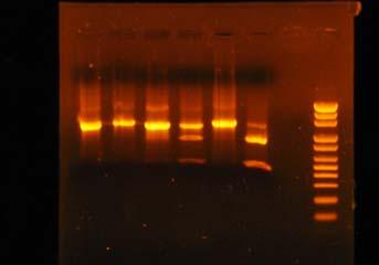 A w s 1 2 3 4 5 B s1 s2 s3 s4 st 1 2 3 4 5 결론 1) 이약의가루 0.1 g을달아물 4 ml 를넣고수욕에서 15 분간가열하고식힌다음여과한여액을가지고다음시험을한다. 1 여액 1 ml 에닌히드린시액 3 방울을넣고흔들어섞어 5 분간끓일때남자색을나타낸다. 2 여액 1 ml 에 10 % 수산화나트륨용액 2 방울을넣고흔들어섞은다음 0.