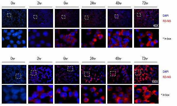 RITC-Dextran-Nanogel 200ug 더한후, 0hr, 24hr, 48hr, 72hr 으로 time dependent하게조건을두었다. Raw264.7이자라있는 cover glass를 24 well plate로옮겨 DPBS washing을해준후 Raw264.