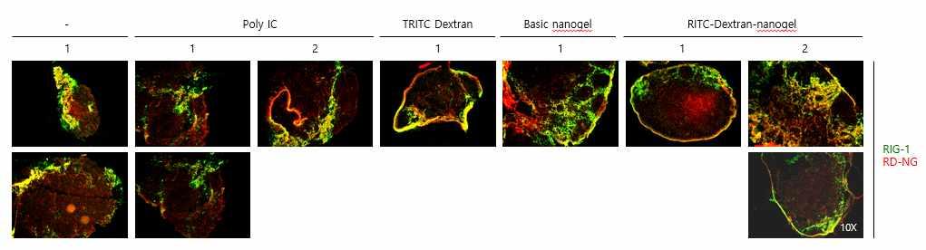 Immunofluorescence결과와비슷하게 Lymph node 에서약하지만 RIG-1의증가를확인할수있었었다 ( 그림 11).