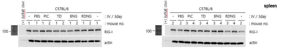 E F 그림 13. RD-NG 에대한 Lymph node 와 spleen 의 RIG-1 의반응. RIG-1을양적으로확인하기위해 western blot을진행하였다. 정확한분석을위해 1set에서반응을보였던 lymph node를부위를나누어분석하였다.