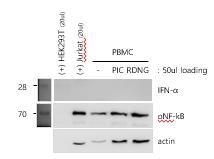 그림 25. 돼지 PBMC 를이용한 Western blot. 상기의내용으로보완하여실험해보았지만세포의양이매우적었으며 phosph-nf-kb가 actin과비례하는양상으로나타났다 ( 그림 25). 지금까지결과로는부족한부분이많으며유사탐식세포를수율을높이는실험을진행하고있다.