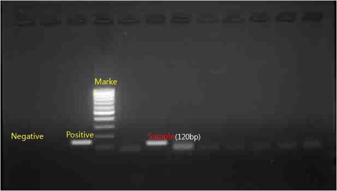 표 Ⅱ-4 말라리아매개모기로부터삼일열말라리아 (Plasmodium vivax) 원충감염확인을위한 PCR 조건 Primer PLU5:5'-CTT GTT GTT GCC TTA AAC TTC-3' PLU6:5'-TTA AAA TTG TTG CAG TTA AAA CG-3' VIV1:5'-CGC TTC TAG CTT AAT CCA CAT AAC TGA TAC-3'