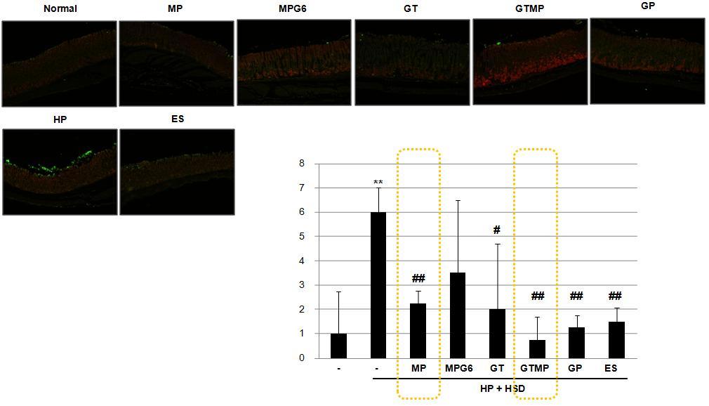 Tunnel assay: apoptosis 즉, 세포사멸과세포손상의정도를확인할수있는 TUNEL assay 를수행하였다.