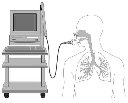 개념코드 ( 구 ) 영문명 한글명 KS0449230 Ovarian branches of uterine artery 자궁동맥의난소가지 KS0449231 Tubal branch of uterine artery 자궁동맥의자궁관가지 KS0448608 Superior horn of thyroid cartilage 방패연골위뿔 KS0448621