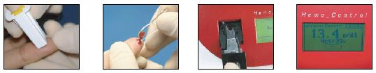 휴대용헤모글로빈측정기사용시유의사항 측정기의전용채혈침 (Lancet) 을사용하도록함 테스트큐벳은습도에민감하므로반드시지정된통에보관하고뚜껑을꼭닫아습기가없는곳에보관하여야함 장비에문제가없는지확인하기위해컨트롤큐벳을이용하여장비시리얼번호와의일치여부를장비사용전에반드시점검하도록함