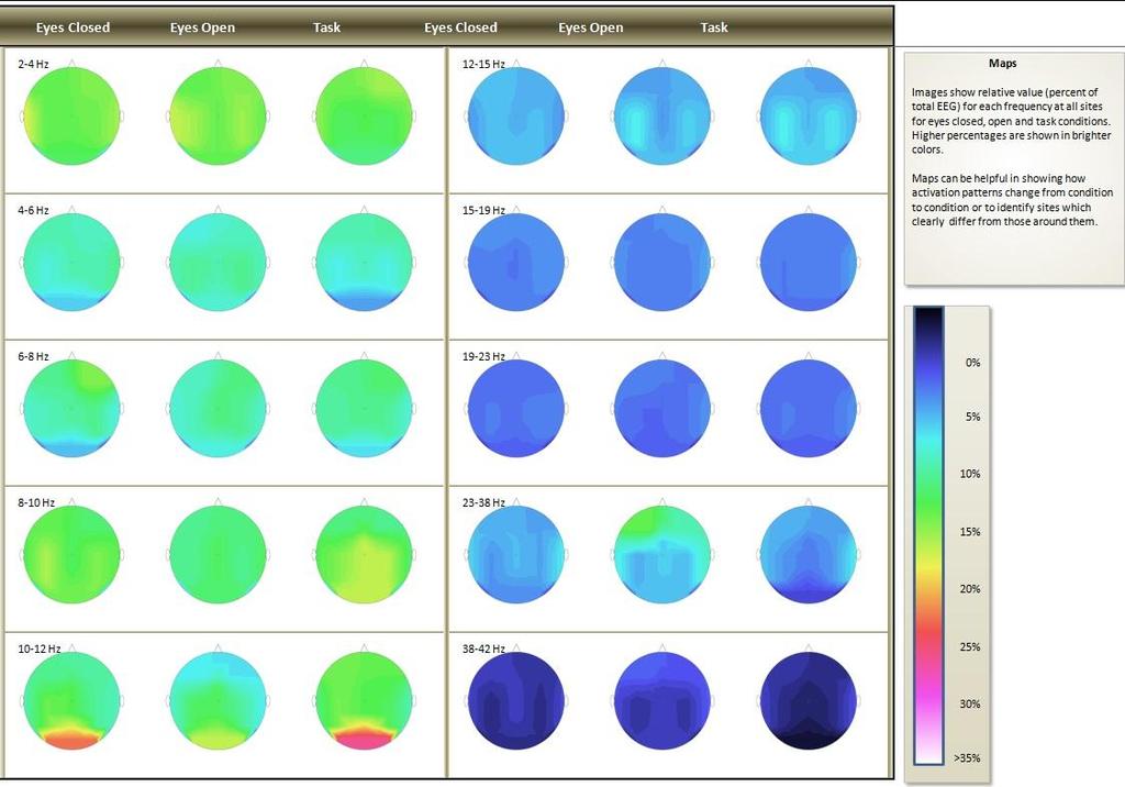 BEAM 배경뇌파검사표준파형 Standard Mapping 사례알파대역 (10~12Hz) 시지각패턴 (α-attenuation)