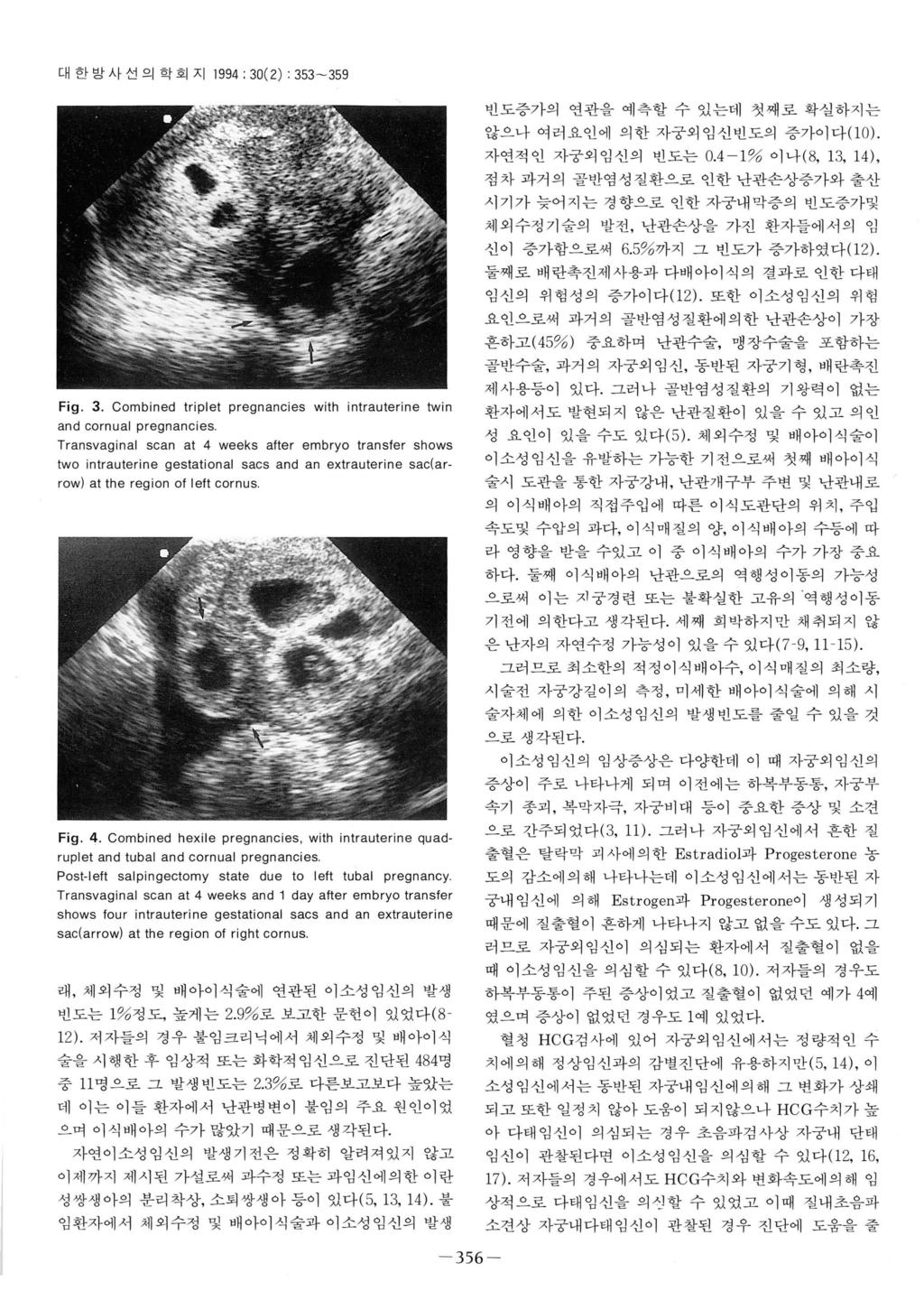 대한밤사선의학회지 1994: 30(2) : 353-359 Fig 3.