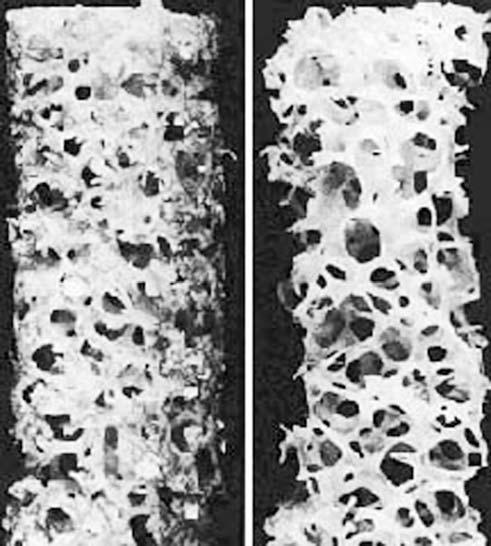 Kyung-Hoon Kim et al.: Diagnosis for Osteoporosis 4) 정량적전산화단층촬영 (QCT; Quantitative Computed Tomography) 복부 CT와동일한조건으로 hydroxyapatite (K 2 HPO 4 ) 로구성된골밀도대조용팬텀위에누워서촬영한다.