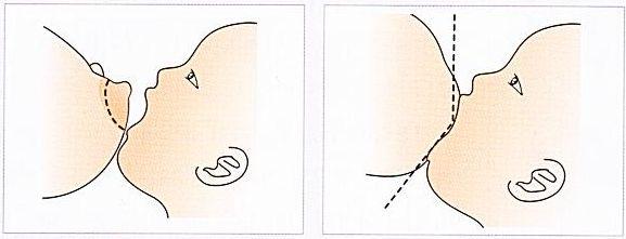 아래그림 올바른젖물리기 와 잘못된젖물리기 를통해아기의입이적절히벌어진정도를확인할수있다.