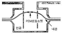 < 내과이음시공도 > < 실제시공도 > < 관구마개 > [ 그림 4-17] 내관이음 < 예시 > 나 ) [ 그림 4-17]