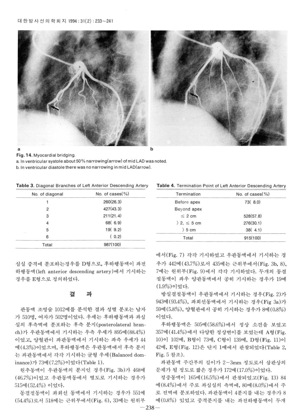 대한방사선의학회지 1994: 31(2) : 233-241 a b Fig. 14. Myocardial bridging. a. In ventricular systole about 50 % narrowing(arrow) of mid LAD was noted b.