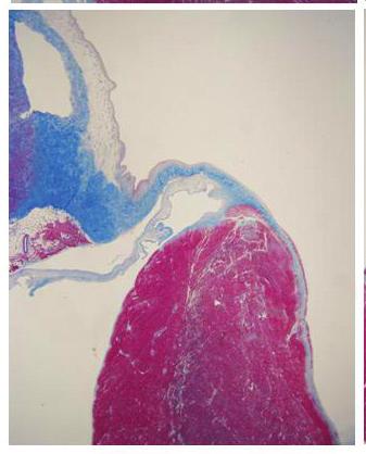 Short arrows indicate the plane between myocardial layers where the right bundle is located (Masson s trichrome stain).