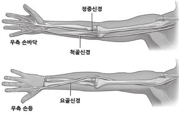 증상은부기, 통증, 및팔꿈치운동곤란등이있습니다. 감염부위가빨개지면서따뜻해지고부종 이생기기도합니다. 중증이며만성적으로재발할때에는수술이필요할수도있습니다. 발생원인은오랫동안압력을받거나갑작스러운외상에의해점액낭에자극이가해지면서염증이발생하는것입니다.