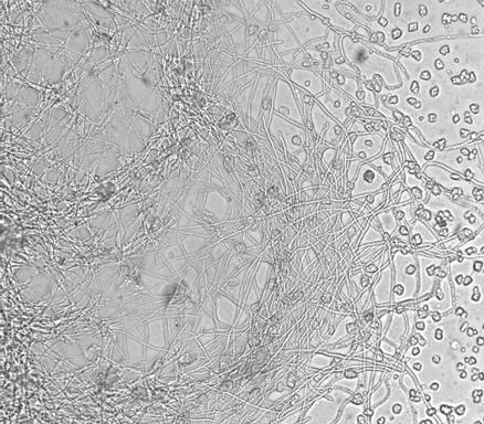 그림 3.1.37. Photo of Aspergillus niger KCTC 6911 (x400 : Nikon Eclipse E600) 그림 3.1.38.Photo of Aspergillus niger KCTC 6982.