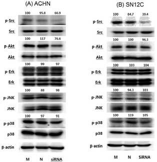 The objective of this study was to determine whether TRPM7 regulate RCC cells migration and invasion through linkage with one or more signal transduction pathways.