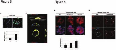 본연구자는 adult 정상신장조직을이용하여 organoid 배양법에성공하여보고하는바이다. 대상및방법 : 정상신장의조직을얻어조직을분리하고이를 3D 배양법및 3D on-top 배양법을사용하였다. 대조군으로는상용화된 primary normal tubule cell (ATCC) 과비교하였다.