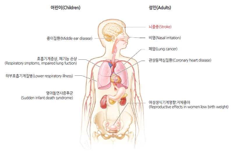 간접흡연노출에의한건강문제 미국보건복지부 2004,2006 주 : 붉은색으로표시된질환은 2014 년도미국공중보건국장보고서에서새롭게보고된흡연관련질환임 (The Health Consequences of Smoking-50 Years of Progress.