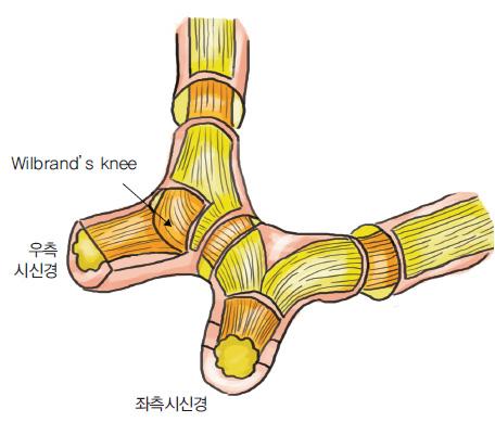 대부분은교차가뇌하수체의바로위에있으나약 15% 에서는안장결절 (tuberculum sallae) 위에놓여있어앞에고정된 (prefixed) 교차이고, 약 5% 에서는안장등 (dorsum sellae) 위에놓여있는뒤에고정된 (postfixed) 교차라고한다.