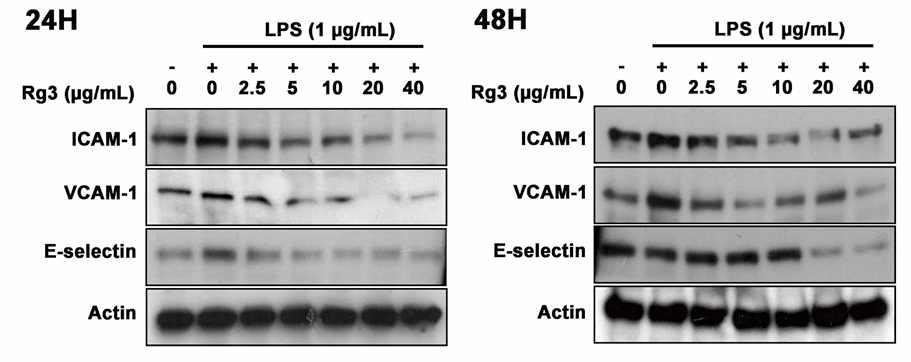 4) HUVEC 에서진세노사이드 Rg3 에의한세포부착분자단백질발현변화 - HUVEC 에 LPS 를처리한후진세노사이드 Rg3 를처리한후웨스턴블랏방법을이용하 여 VCAM-1, ICAM-1,