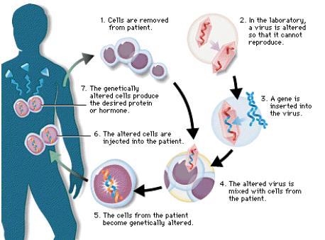ex vivo 방식의유전자치료법의메커니즘