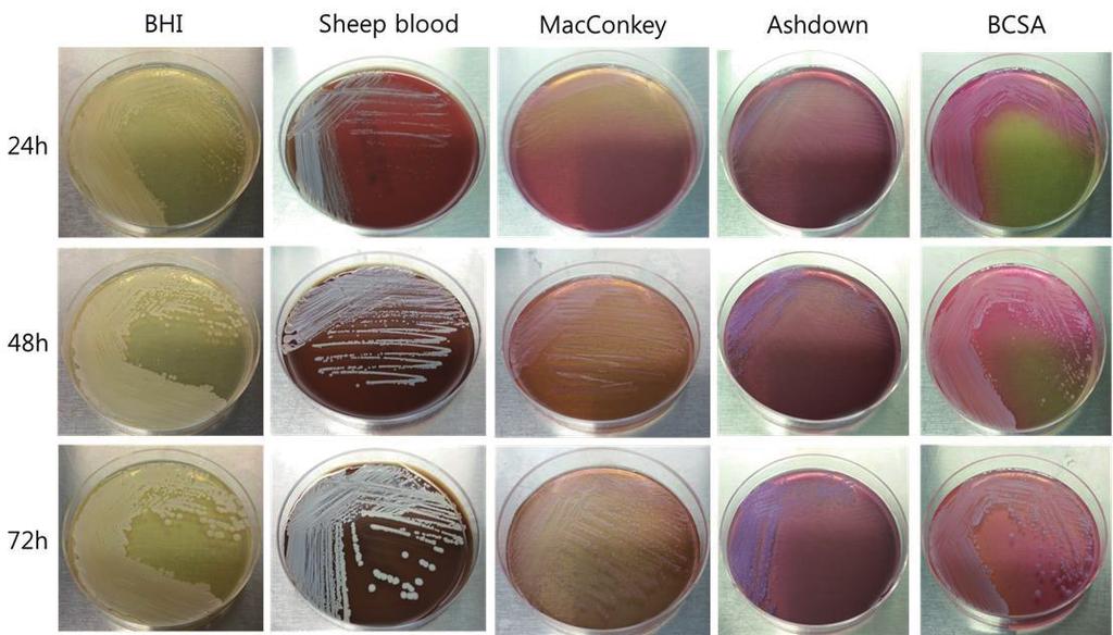 Vol. 8 No. 40 PUBLIC HEALTH WEEKLY REPORT, KCDC Figure 2. Colonial growth morphology of Burkholderia pseudomallei. 나.