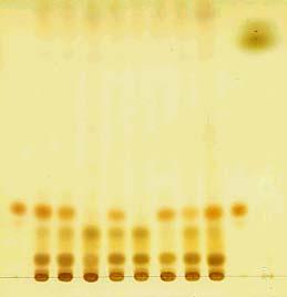 8) 을전개용매로하여약 10 cm 전개한다음묽은황산시액 (A) 또는 2,4- 디니트로페닐히드라진시액을 (B) 고르게뿌렸을때 3 번과 5 번을제외한모든검액에서얻은여러개의반점중 1 개의반점은표준액에서얻은반점과색상및 R f 값이같았다. 참고로 5- 히드록시-2-푸르알데하이드 (st2) 반점은확인할수없었다.