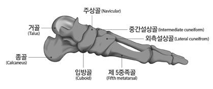 3) 발가락을잃었을때 라함은첫째발가락에서는지관절부터심장에가까운쪽을, 나머지네발가락에서는제 1 지관절 ( 근위지관절 ) 부터심장에서가까운쪽을잃었을때를말한다. 4) 리스프랑관절이상에서잃은때라함은족근 - 중족골간관절이상에서절단된경우를말한다.