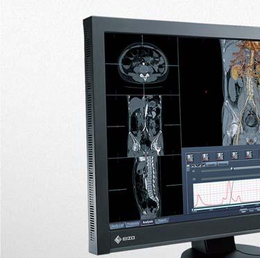 Clinical Review Monitors 비용대비효율성이매우높은 EIZO