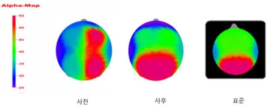 학교안놀이활성화를위한정책토론회학교, 놀이를품다 다. 문제행동증후군의모든요인에서긍정적인변화가나타난것이다. 아이들의불안및우울이 33%p, 주의집중문제가 34%p, 총문제행동은 41%p나줄어들었다고응답했다. 특히하위 10% 의경우문제행동증후군사전점수가매우높았으나놀이활동이후실험에참가한다른아이들과거의비슷한수준으로낮아졌다. 뇌파도달라졌다.