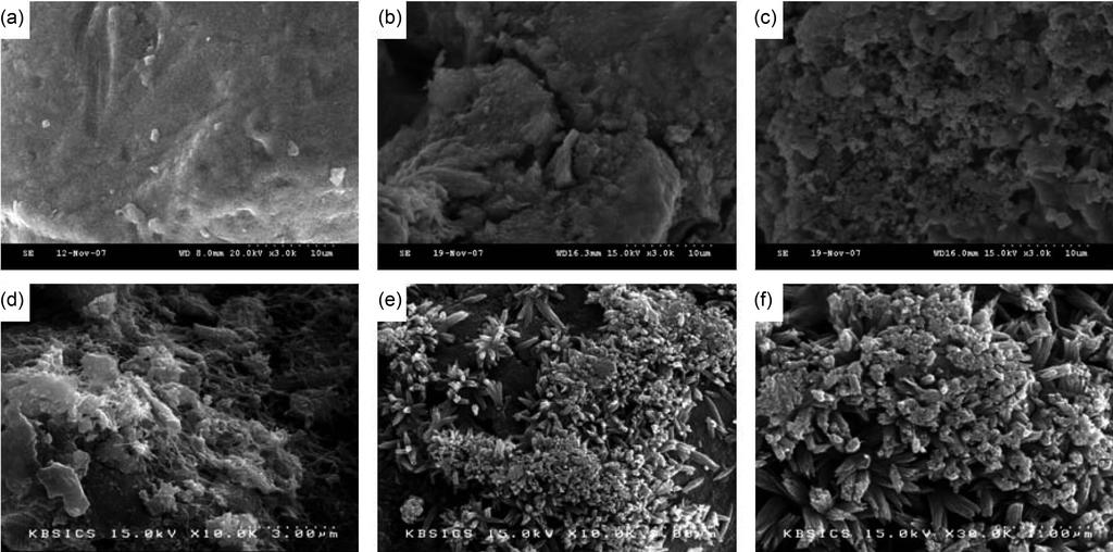 티타늄분말의 표면에 석출된 생체모방 아파타이트 Fig.. Fig.. 19 SEM micrgraphs f the surfaces f the titanium pwder after saking in SBF fr (a) 1, (b), (c) 5, (d) 7, and (e, f) 16 days.