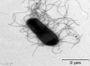 미생물농약의개발현황과바실러스미생물의중요성 (A) Figure 7. EXTN-1 의균세포모양및오이모자익바이러스억제효과 (A: Bacillus vallismortis EXTN-1, B: CMV 억제 ). (B) Figure 8.