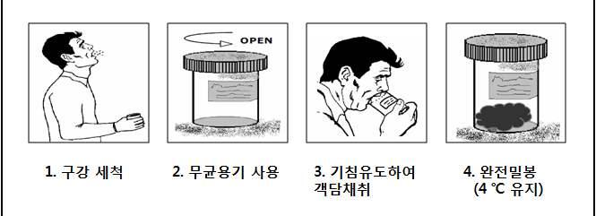 - 기관지폐포세척액 (Bronchoalveolar lavage fluid, BAL) : 국소병변 (focal lesion) 이관찰되는폐엽 (lobe) 에서호흡기내과전문의주관으로채취 상기도검체채취방법 - 비인두도찰물과구인두도찰물을동시에채취하여하나의 VTM 배지에담아수송 - 비인두도찰물 (Nasopharyngeal swab) : 콧구멍을지나하비갑개중하부 (