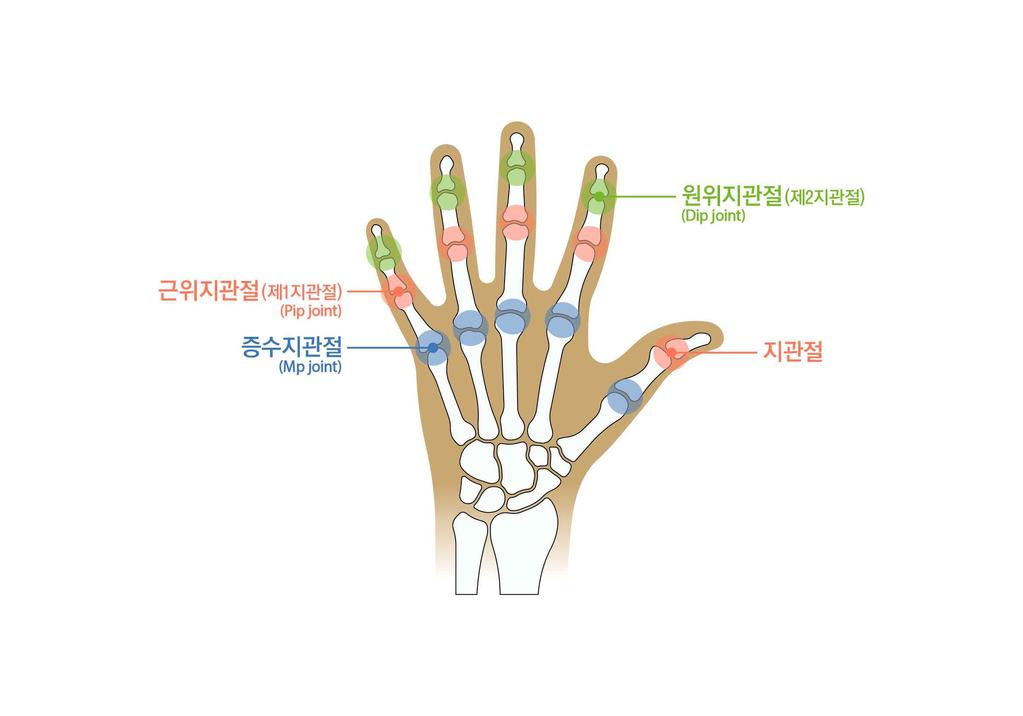 7) 손가락에뚜렷한장해를남긴때 라함은첫째손가락의경우중수지관절또는지관절의굴신 ( 굽히고펴기 ) 운동영역이정상운동영역의 1/2 이하인경우를말하며, 다른네손가락에서는제 1, 제 2 지관절의굴신 ( 굽히고펴기 ) 운동영역을합산하여정상운동영역의 1/2 이하이거나중수지관절의굴신 ( 굽히고펴기 ) 운동영역이정상운동영역의 1/2 이하인경우를말한다.