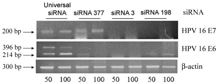 Cells were transfected with universal sirna, sirna 377, sirna 3 and sirna 198 at 50 nm. Immunoblot analysis using specific p53 antibody was performed after 24 and 48 hours.