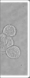 or Ligand or Antibody z 리간드 및 항체가 결합된 양자점을 주입: 생체 밖(in-vitro) 및 생체