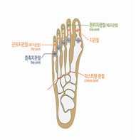 3) 발가락을잃었을때 라함은첫째발가락에서는지관절부터심장에가까운쪽을, 나머지네발가락에서는제 1 지관절 ( 근위지관절 ) 부터 ( 제 1 지관절포함 ) 심장에서가까운쪽을잃었을때를말한다.