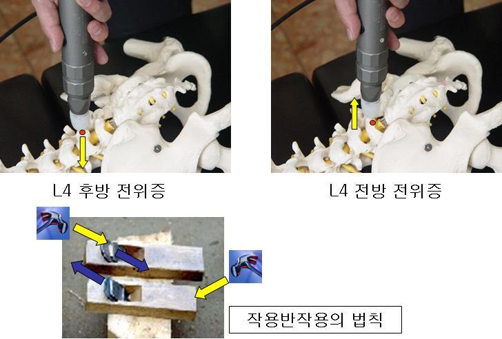 요추부교정법 Lumbar region (+