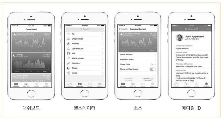 분마다측정되고이데이터는 Dexcom의아이폰어플리케이션으로전송된다. 이앱은다시 Healthkit 로데이터를보내고 Healthkit 는 Epic의 Mychart 앱을통해 Epic의 EHR로데이터를전송하여위험수준의결과값발생시즉시경고메시지를보내게된다.