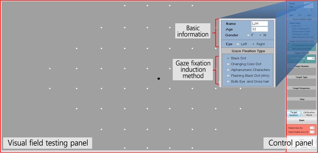 , 2007) 으로하였고, 주변시표는표준자동시야계 (SAP) 의 central 24-2 test pattern (superior, inferior, nasal 24, 그리고 temporal 30 영역내에 6 간격의 54 개 grid 의각중심에시표가위치함 ) 을기반으로제 시되었다.