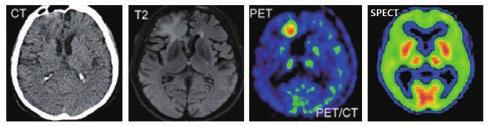 resonance image, MRI) 등이있다 (< 그림 2>). 뇌영상의기본적인정보는조직영상 (histology image) 과같은예외적인경우를제외하고는일반적으로 수있으며, 중간단계를사용하여다중비교문제도줄일수있다 [4]. 복셀 (voxel) 기반으로저장되어있다.
