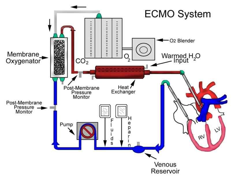 (extracorporeal