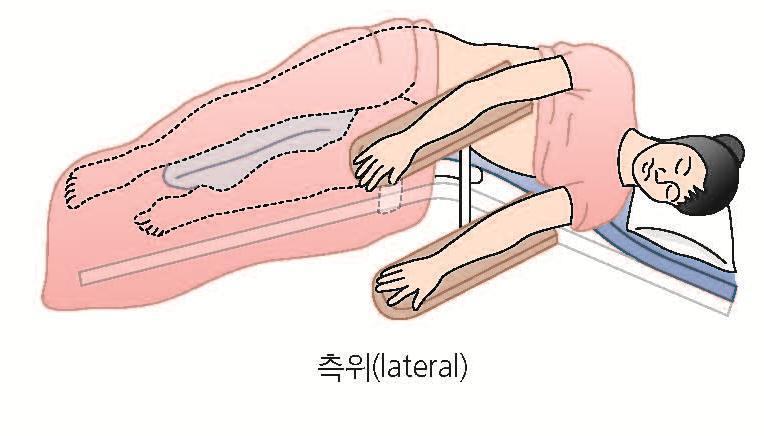 3. 수술중처치 수술체위 측위 lateral position 옆으로누운체위 신장,