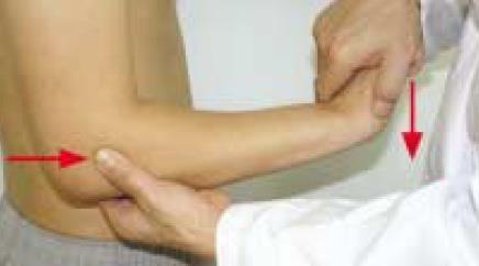 4) 진단과평가 1 Mill test : wrist & hand full flexion 시 pain 2 Maudsley( 마우드슬리 ) 검사