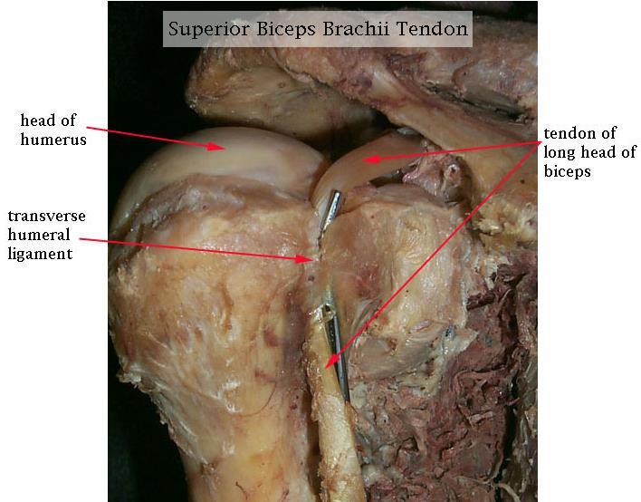 2.Tendon( 건 ) 1 교원섬유속과섬세한횡단섬유로구성. 2 탄력성은적다. 3 두개골, 복부 ; aponeurosis ( 널힘줄 ).