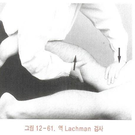 ᄃ역 Lachman 검사. Slocum Test ; - 앞, 안쪽불안정성검사와앞가쪽불안정성검사.